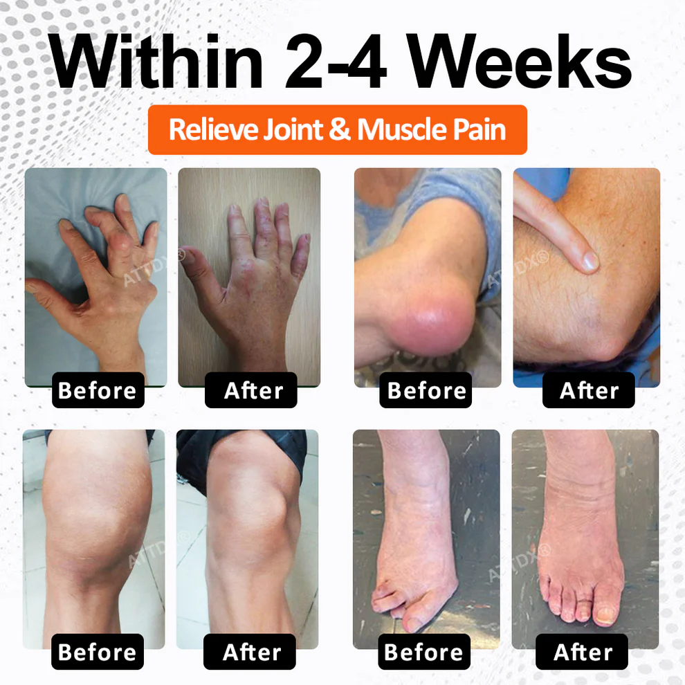 ATTDX® Mobility Max Magnesium Complex Softgels image ATTDX® Mobility Max Magnesium Complex Softgels