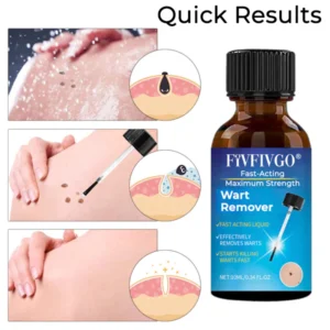 Fivfivgo® Fast-Acting Maximum Strength Wart Remover