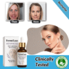 FerméLuxe – Visibly Reduces Up to 93% of Dark Spots in Just 3 Weeks