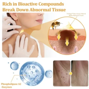 Fivfivgo™ TagCure Bee Venom Wart & Moles Removal Cream