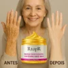 Hand Mask - RtopR - Eliminates age spots image Hand Mask - RtopR - Eliminates age spots