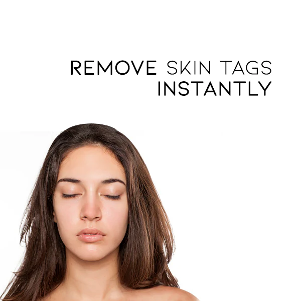 Fivfivgo™ WipeOff Tags & Mole Remover image Fivfivgo™ WipeOff Tags & Mole Remover
