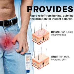 Fivfivgo® Scrotum Itchy Treatment Cream image Fivfivgo® Scrotum Itchy Treatment Cream