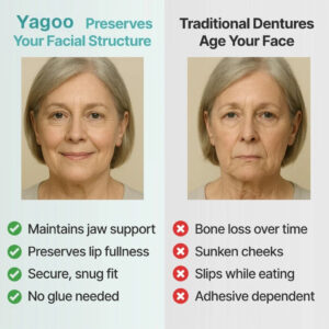 Yagoo™ Medical Full Denture image Yagoo™ Medical Full Denture