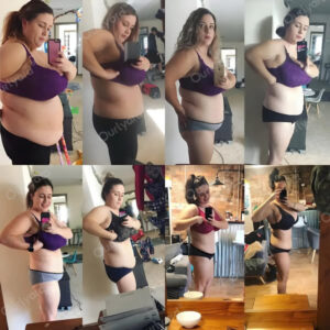 Ourlyard Tirzepatide Nano Patch