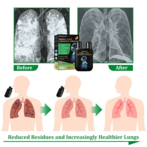 Ourlyard™ Herbal Lung Cleansing Inhaler image Ourlyard™ Herbal Lung Cleansing Inhaler