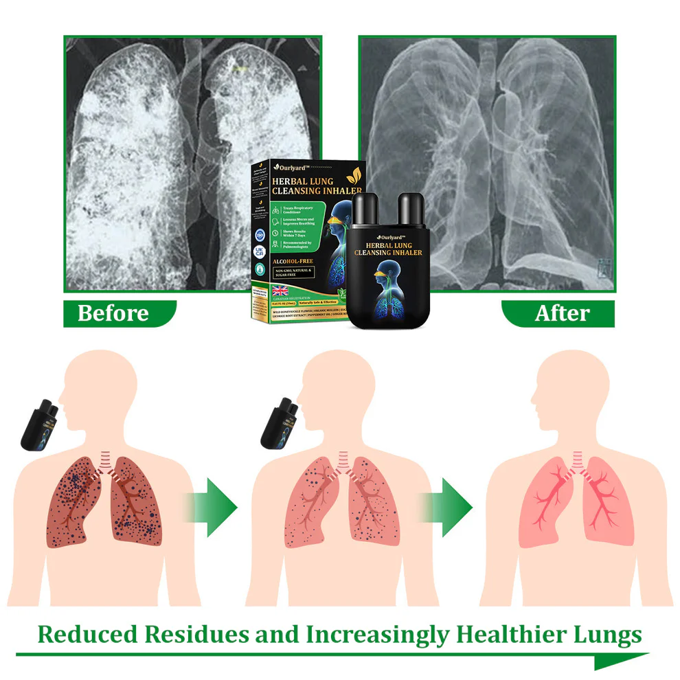 Ourlyard™ Herbal Lung Cleansing Inhaler image Ourlyard™ Herbal Lung Cleansing Inhaler