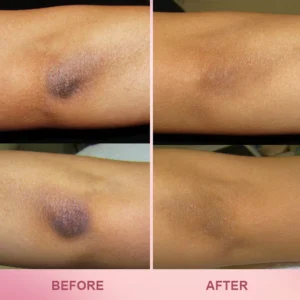 LIMETOW™ Whitening Skin Stick image LIMETOW™ Whitening Skin Stick LIMETOW™ Whitening Skin Stick