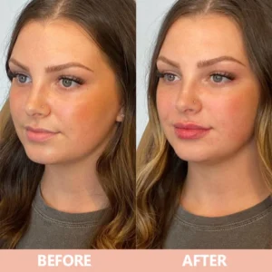 LIMETOW® Lip Plumper Kit image LIMETOW® Lip Plumper Kit