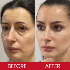 LIMETOW® Retinol Eye Stick image LIMETOW® Retinol Eye Stick