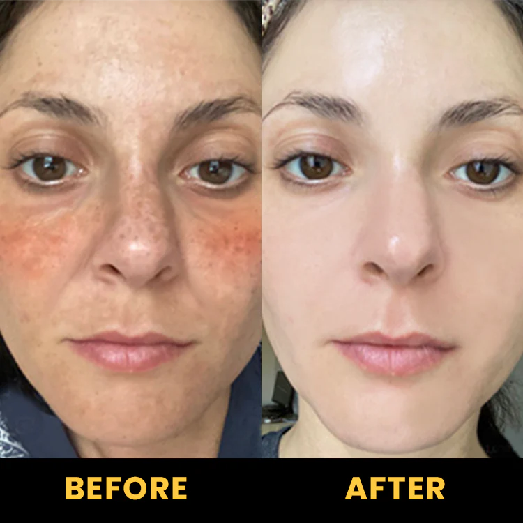 LIMETOW™ Propolis Moisturizing and Repairing Essence Stick image LIMETOW™ Propolis Moisturizing and Repairing Essence Stick