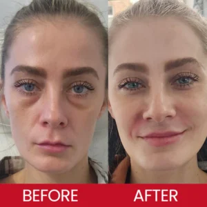 LIMETOW® Retinol Eye Stick image LIMETOW® Retinol Eye Stick