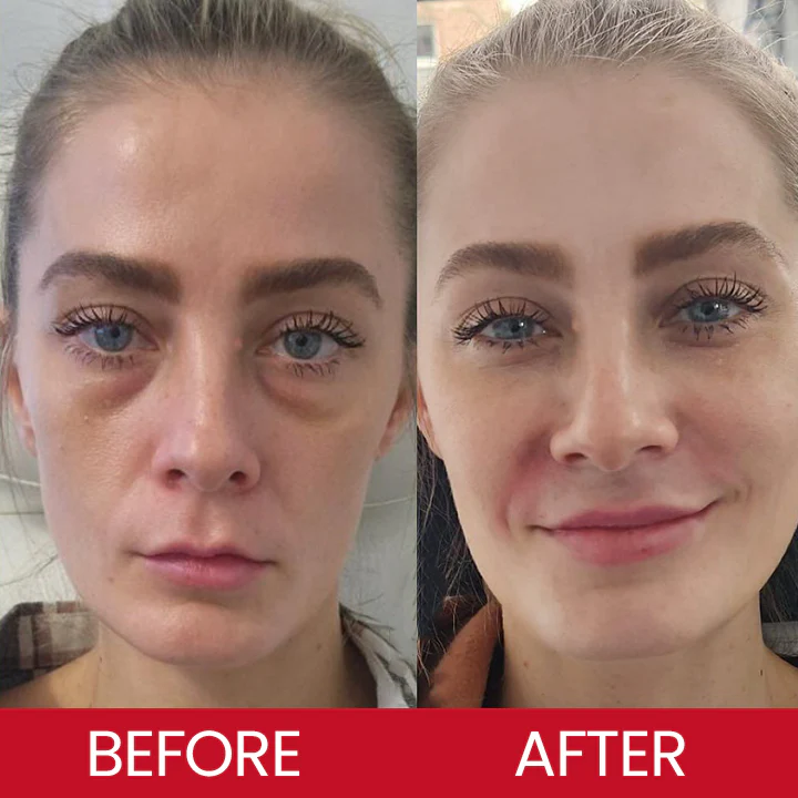 LIMETOW® Retinol Eye Stick image LIMETOW® Retinol Eye Stick