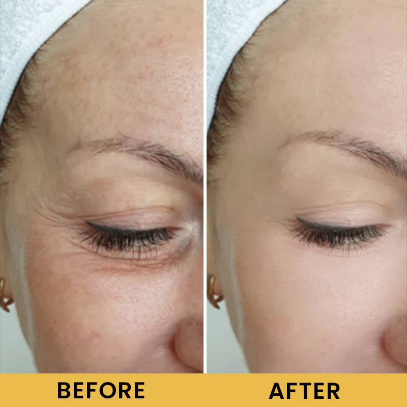 LIMETOW® Wild Ginseng Anti-Aging Essence image LIMETOW® Wild Ginseng Anti-Aging Essence