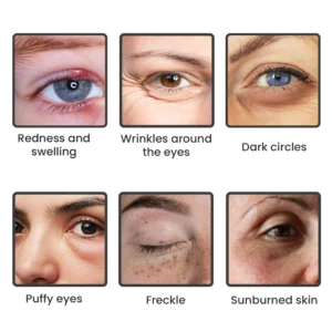 LIMETOW™ Instant Eye Cream Tightener image LIMETOW™ Instant Eye Cream Tightener