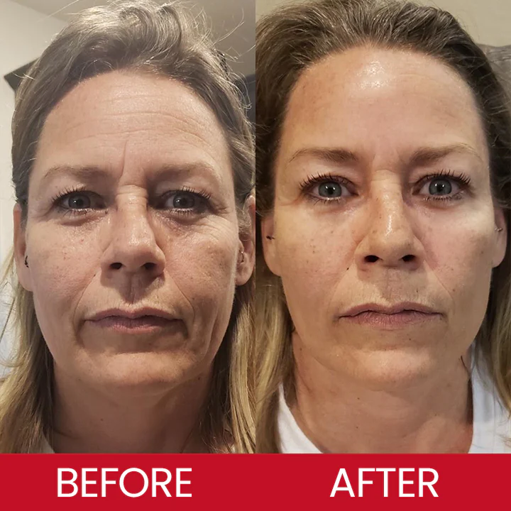 LIMETOW® Retinol Eye Stick image LIMETOW® Retinol Eye Stick