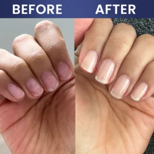 LIMETOW® Nail Repair Solution image LIMETOW® Nail Repair Solution