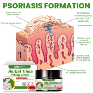 LIMETOW® Herbal Tinea Itching Cream image LIMETOW® Herbal Tinea Itching Cream