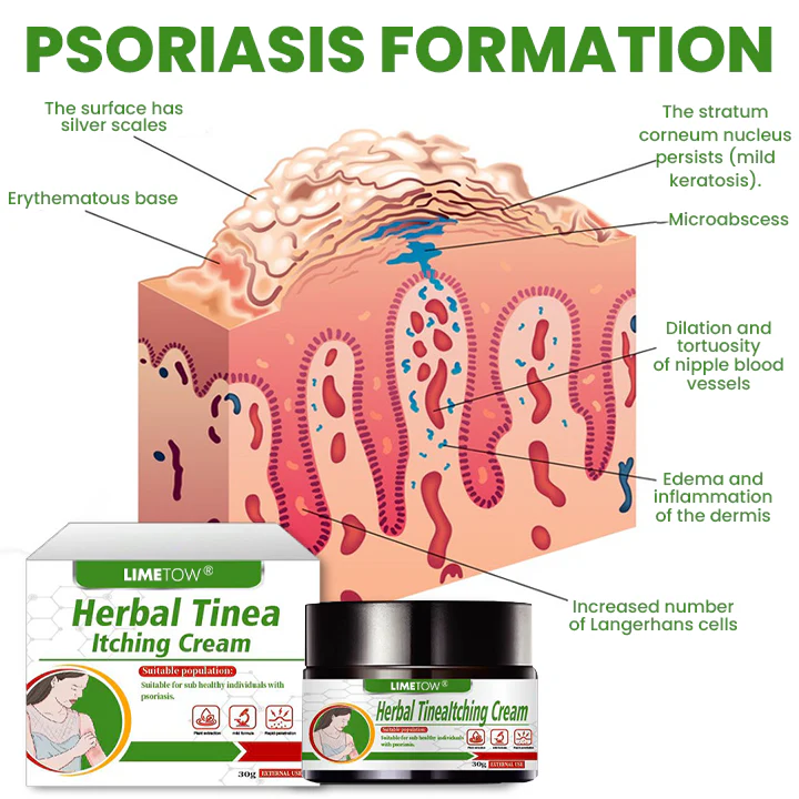 LIMETOW® Herbal Tinea Itching Cream image LIMETOW® Herbal Tinea Itching Cream