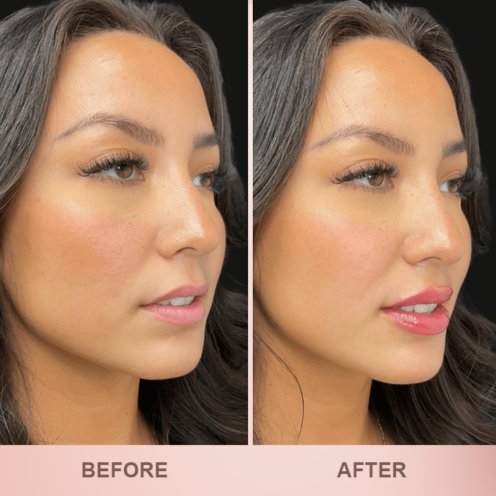 LIMETOW® Lip Plumper Kit image LIMETOW® Lip Plumper Kit - Image 9