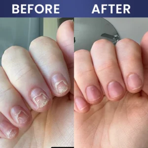 LIMETOW® Nail Repair Solution image LIMETOW® Nail Repair Solution