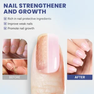 LIMETOW® Nail Repair Solution image LIMETOW® Nail Repair Solution