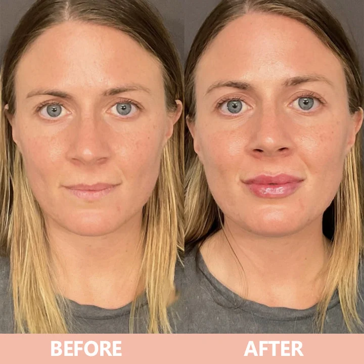 LIMETOW® Lip Plumper Kit image LIMETOW® Lip Plumper Kit - Image 10