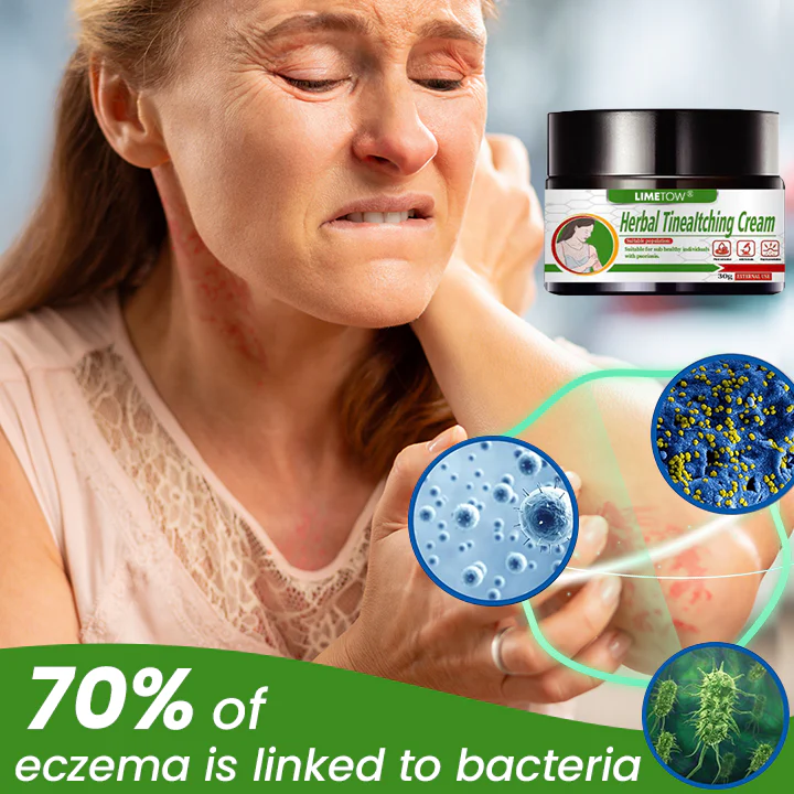 LIMETOW® Herbal Tinea Itching Cream image LIMETOW® Herbal Tinea Itching Cream
