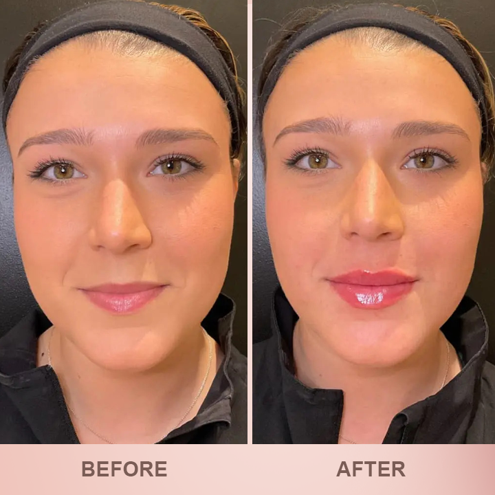 LIMETOW® Lip Plumper Kit image LIMETOW® Lip Plumper Kit - Image 12