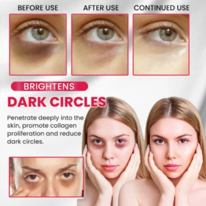 LIMETOW® Retinol Eye Stick image LIMETOW® Retinol Eye Stick