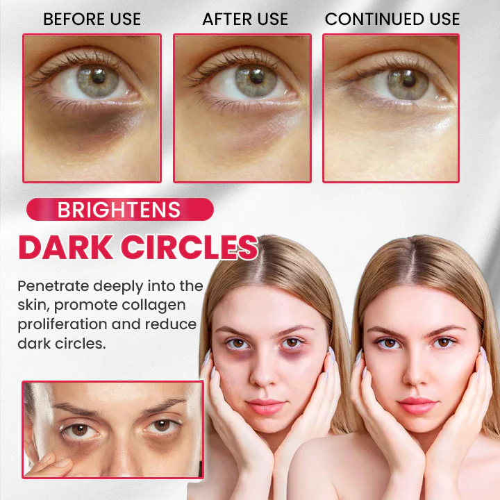 LIMETOW® Retinol Eye Stick image LIMETOW® Retinol Eye Stick