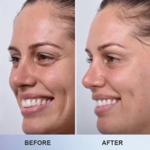 LIMETOW™ Line Smoothing Eye Cream image LIMETOW™ Line Smoothing Eye Cream