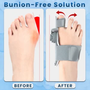 LIMETOW® Bunion-Free Solution