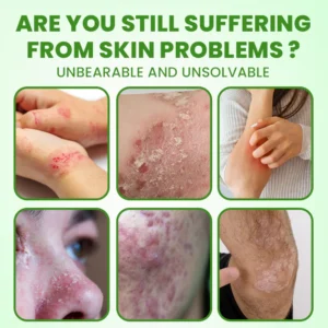 LIMETOW® Herbal Tinea Itching Cream image LIMETOW® Herbal Tinea Itching Cream