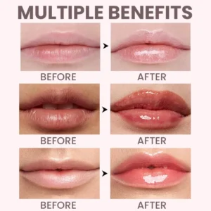 LIMETOW® Lip Plumper Kit image LIMETOW® Lip Plumper Kit