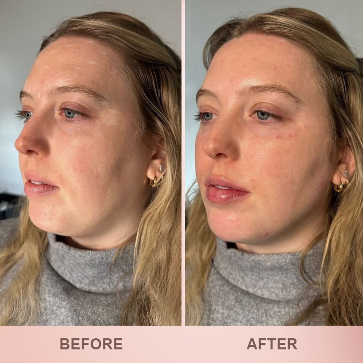 LIMETOW® Lip Plumper Kit image LIMETOW® Lip Plumper Kit - Image 13