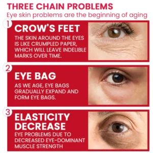 LIMETOW® Retinol Eye Stick image LIMETOW® Retinol Eye Stick