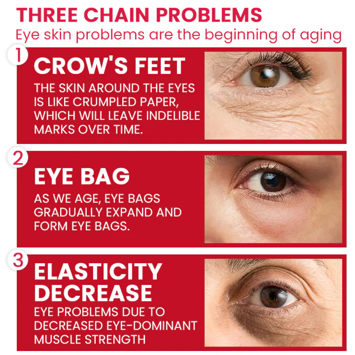 LIMETOW® Retinol Eye Stick image LIMETOW® Retinol Eye Stick