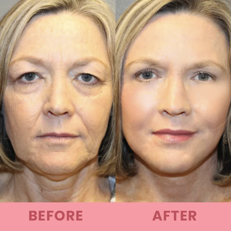 LIMETOW™ Compact Anti-wrinkle Bar image LIMETOW™ Compact Anti-wrinkle Bar