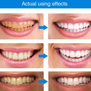 LIMETOW® Teeth Whitening Essence image LIMETOW® Teeth Whitening Essence