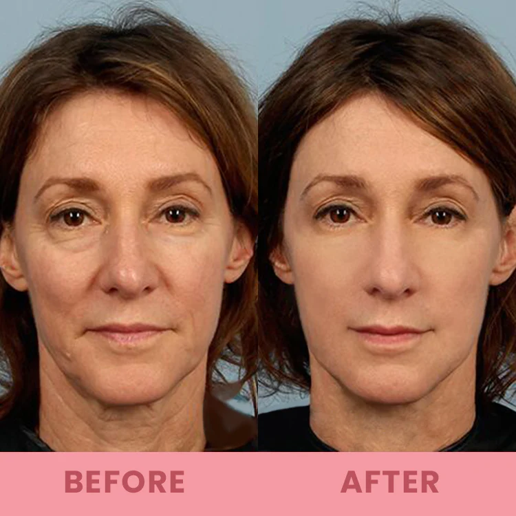 LIMETOW™ Compact Anti-wrinkle Bar image LIMETOW™ Compact Anti-wrinkle Bar