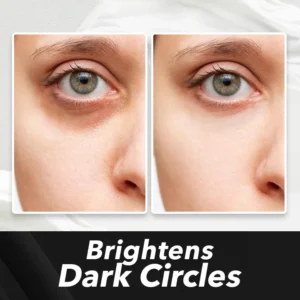 LIMETOW™ Instant Eye Cream Tightener image LIMETOW™ Instant Eye Cream Tightener