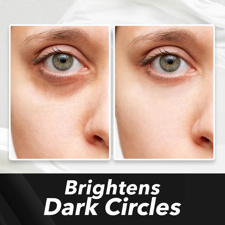 LIMETOW™ Instant Eye Cream Tightener image LIMETOW™ Instant Eye Cream Tightener