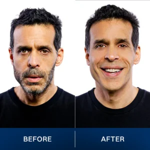 LIMETOW® 2025 New Upgrade Pocket Shaver