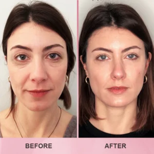 LIMETOW™ Multi Collagen Balm Stick image LIMETOW™ Multi Collagen Balm Stick