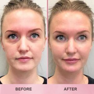 LIMETOW™ Multi Collagen Balm Stick image LIMETOW™ Multi Collagen Balm Stick