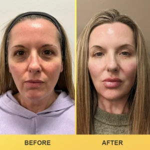 LIMETOW® Revive Eye Cream image LIMETOW® Revive Eye Cream