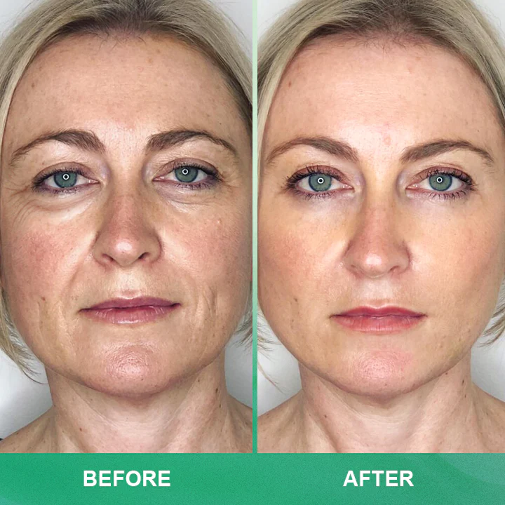 LIMETOW™ Anti-wrinkle Cream Stick image LIMETOW™ Anti-wrinkle Cream Stick