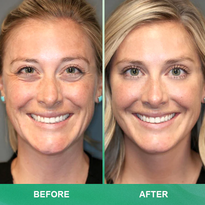 LIMETOW™ Anti-wrinkle Cream Stick image LIMETOW™ Anti-wrinkle Cream Stick