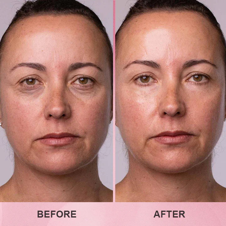 LIMETOW™ Multi Collagen Balm Stick image LIMETOW™ Multi Collagen Balm Stick